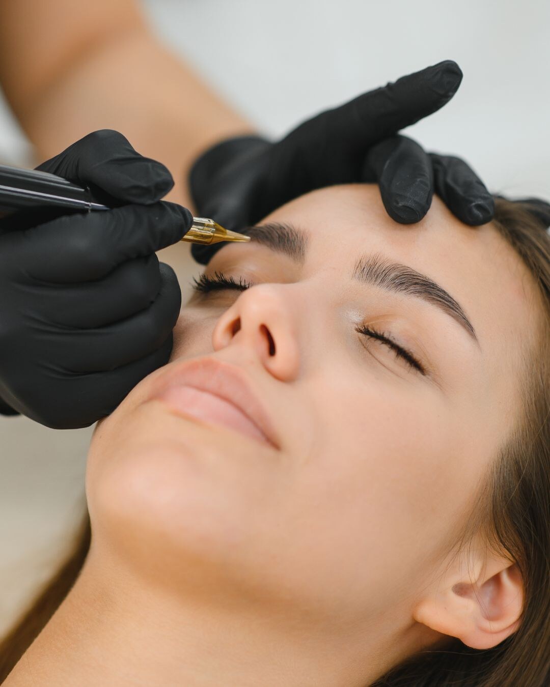 Behandlungsergebnis im Prestige Beautypoint